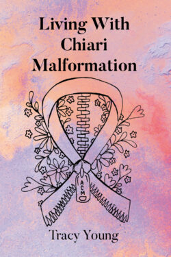 Living With Chiari Malformation